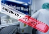 DOMÁCA IZOLÁCIA A KARANTÉNA - Čo robiť po kontakte s pozitívnou osobou a ako postupovať v prípade pozitívneho výsledku testu na COVID-19